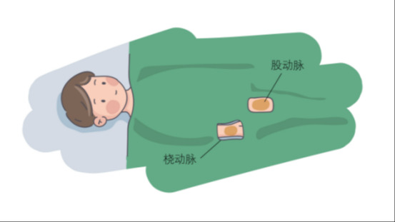 冠狀動(dòng)脈造影的檢查步驟