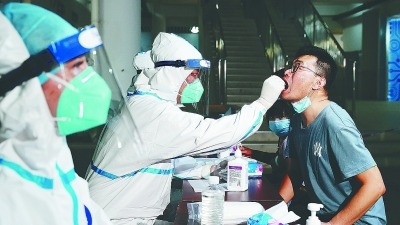 成都小区现100元高价民间核酸检测做核酸检测一次应该多少钱