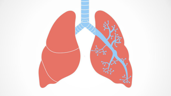 如何诊断肺癌才能确诊？肺癌5种诊断方法最常用