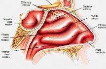 鼻竇氣壓性創(chuàng)傷