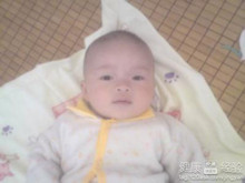 小儿哮喘性肌萎缩综合征