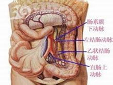 小儿继发性腹膜炎