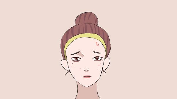 女性到底如何才可以去痘印