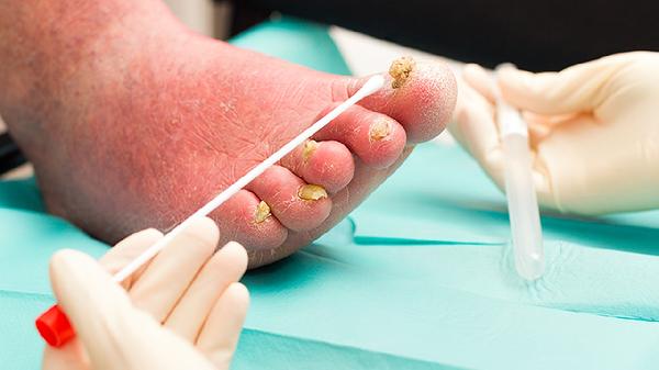 高地方跳下來(lái)腳后跟疼痛腫了