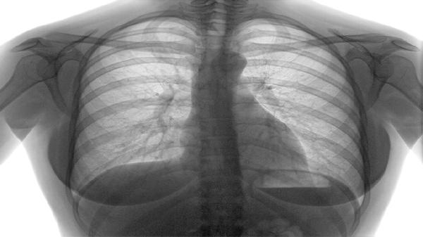 胃癌病人的食疗方法有哪些 介绍3个食疗方给胃癌病人