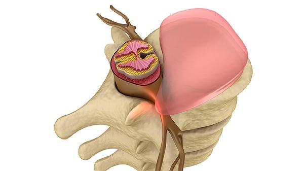 胰腺神經(jīng)內(nèi)分泌腫瘤診斷相關(guān)檢查有哪些