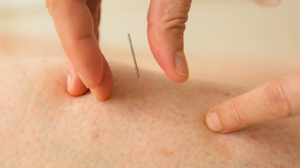 中醫(yī)針灸如何治療腦萎縮 針灸四個(gè)穴位助你改善腦萎縮