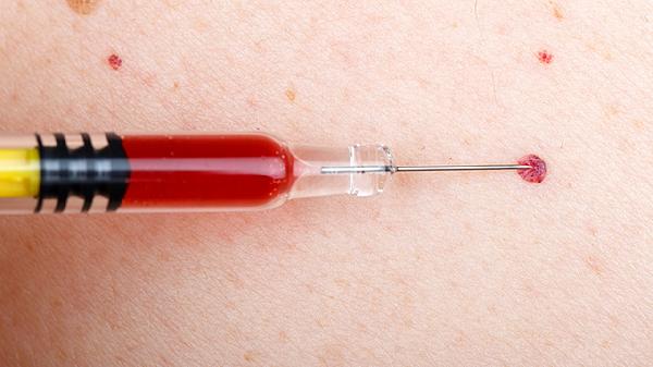 HPV16阳性，出血是不是癌变了
