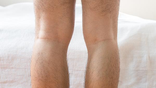 大腿肌肉攣縮是怎么回事 大腿肌肉攣縮的3個原因淺析