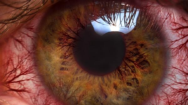 如何预防红眼病 预防红眼病的7个方法