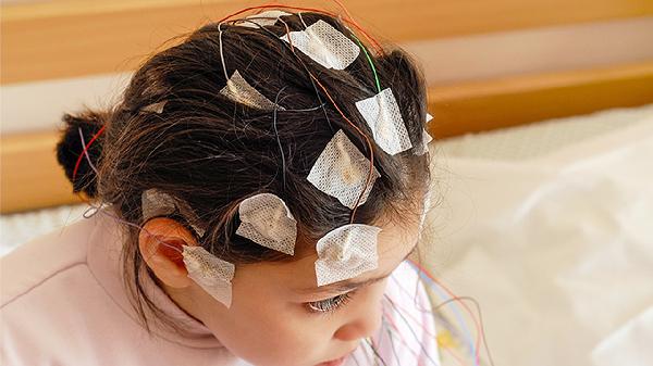 幼儿得面神经炎的原因有哪些