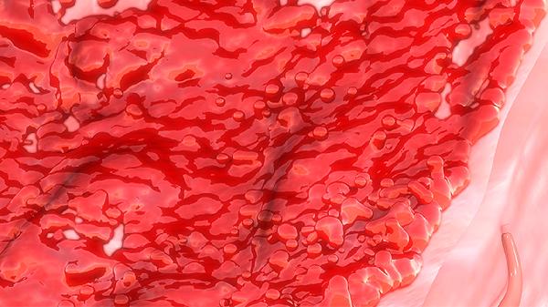 低磷血癥和高磷血癥有什么區(qū)別