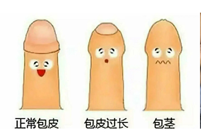 小朋友包莖怎么翻