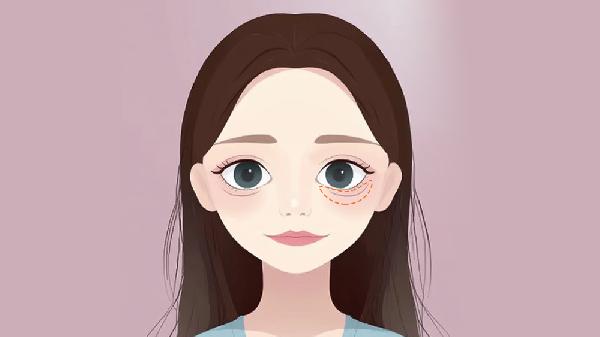 一笑就有卧蚕是什么眼