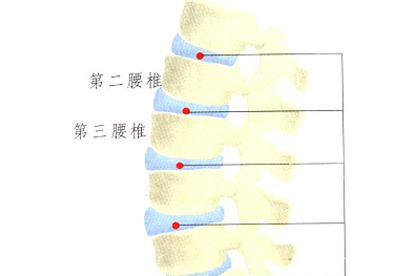 早上起床腰酸背疼怎么回事