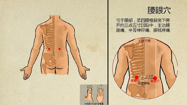 中医怎样治疗颈动脉斑块