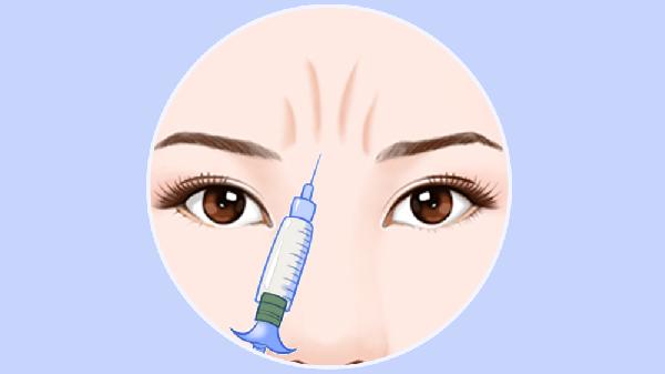 額頭上的川字紋怎么樣才能消除