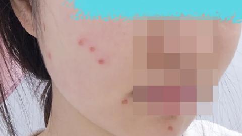 伤疤结痂不掉的原因