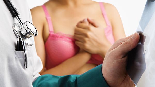 切副乳手术多久恢复