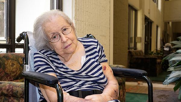 70岁老人股骨颈骨折保守治疗方法