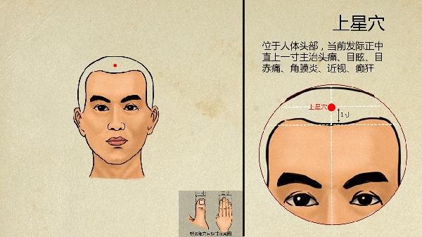 中医看内分泌失调好吗