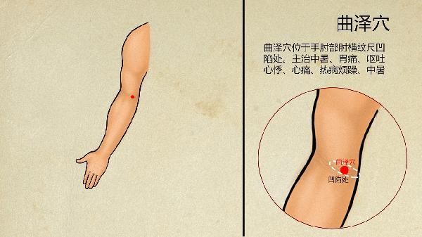 中医治疗反流性食管炎的方法