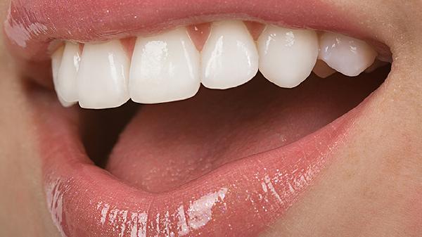 全瓷牙和烤瓷牙的區(qū)別有哪些