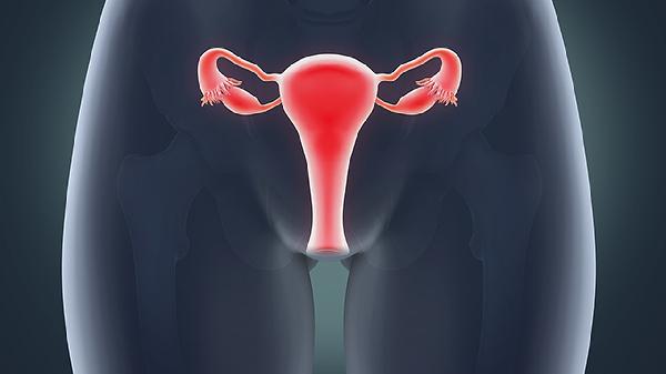 女性長期便秘患宮頸癌