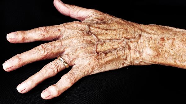 秦艽的功效与作用是什么