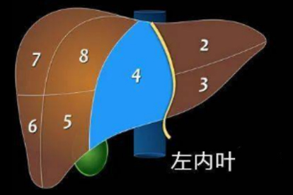肝功碱性磷酸酶高是怎么回事？