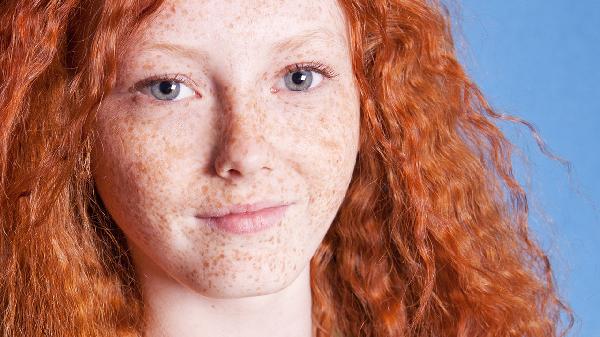 如何快速祛斑美白的方法