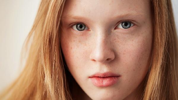 光子嫩膚去除斑點(diǎn)的效果如何