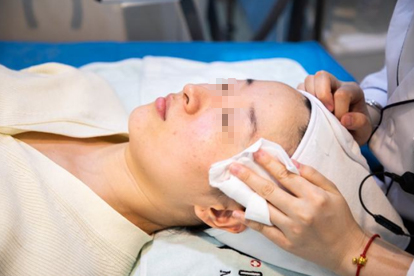 年輕女孩的護膚措施是什么