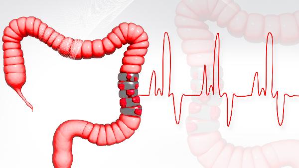 膀胱乙狀結(jié)腸瘺需要什么樣的檢查