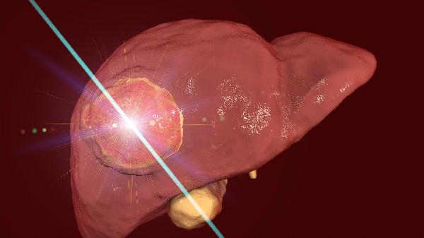 瘦人胆固醇高是什么原因造成的呢