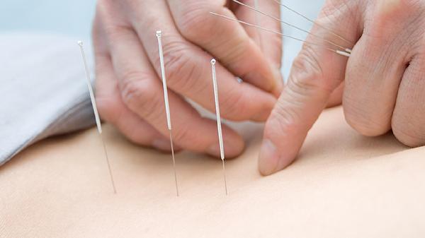 埋線(xiàn)三天了沒(méi)消腫怎么看