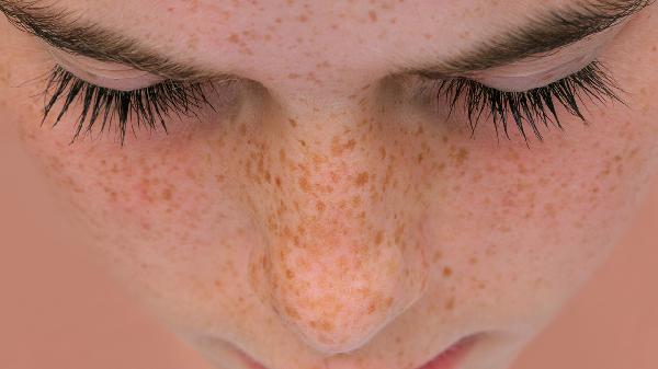 自己在家臉部刮痧祛斑有用嗎