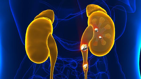 腎積水吃什么食物對腎臟有好處呢