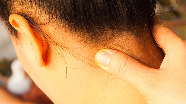 頸紋深有什么辦法去除