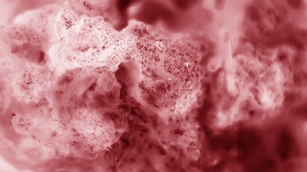 近日突然出来的炭疽是什么病 该如何有效预防