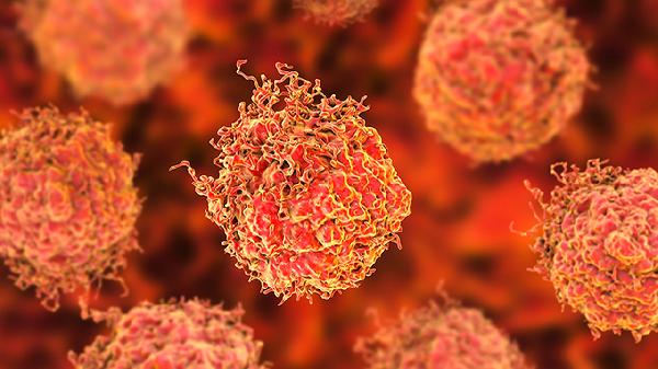 厨房油烟会致癌吗