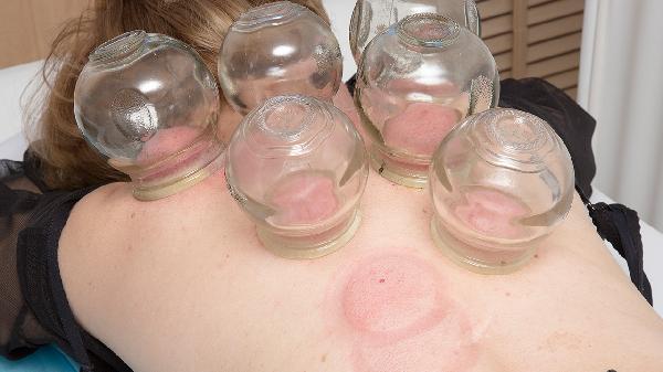 肚子有脹氣拔罐拔哪里