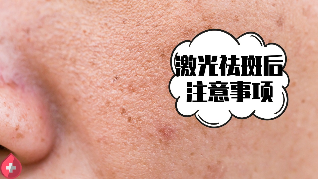 {激光祛斑后需要注意什么 激光祛斑后皮肤发痒正常吗}