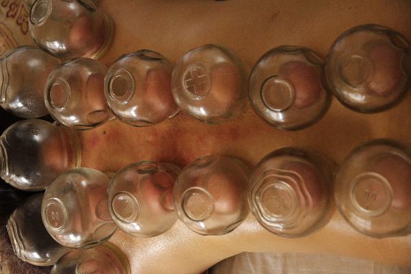 胸下垂了還能變挺嗎中醫(yī)