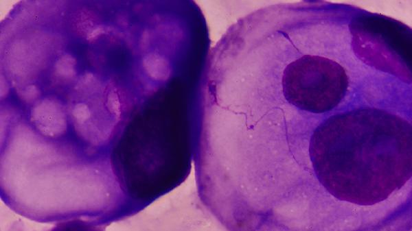 生殖器疱疹病毒会不会终身携带