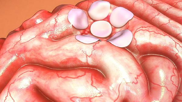 補脾益腸丸什么時(shí)候吃