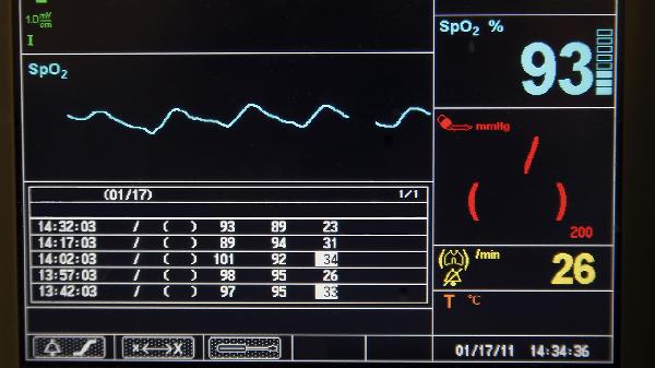 心律不齊的人適合跑步嗎