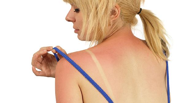 推背能去除体内湿气吗