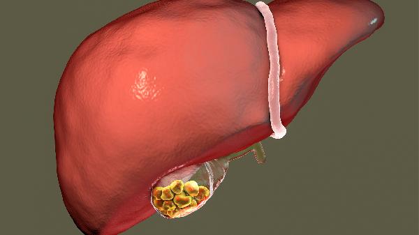 瘦人膽固醇高是什么原因呢吃什么藥