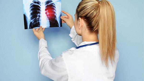 雙肺間質(zhì)性肺炎能活多久呀